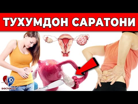 Видео: ДИҚҚАТ! ТУХУМДОН САРАТОНИНИНГ ХАВФЛИ БЕЛГИЛАРИ. ОГОХ БЎЛИНГ!!