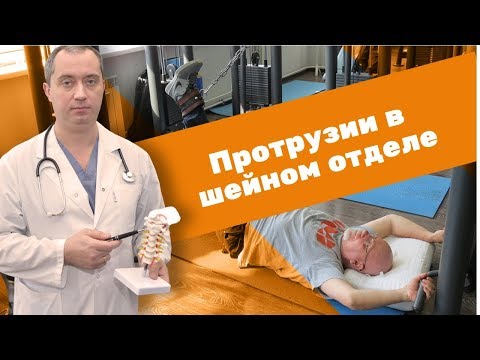 Видео: Протрузии в шейном отделе позвоночника!
