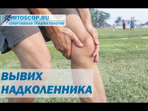 Видео: ВЫВИХ НАДКОЛЕННИКА. СПОРТИВНАЯ ТРАВМАТОЛОГИЯ