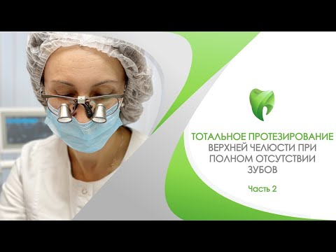 Видео: Тотальное протезирование верхней челюсти при полном отсутствии зубов. Часть 2