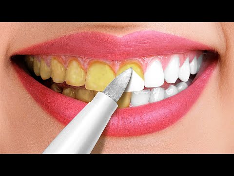 Видео: 30 невероятных лайфхаков для белоснежной улыбки || Бьюти трюки и советы