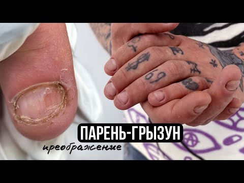 Видео: ПРЕОБРАЖЕНИЕ: РУКИ "ЗЕКА" 😀 Мужской маникюр ГРЫЗУНУ. Титановое покрытие ногтей. ПУДРОВЫЙ маникюр