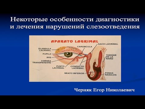 Видео: Некоторые особенности диагностики и лечения нарушений слезоотведения