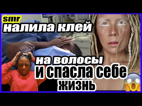 Видео: ЗАЛИЛА ВОЛОСЫ СУПЕРКЛЕЕМ И СПАСЛА СЕБЕ ЖИЗНЬ. Полная история Gorilla Glue Girl