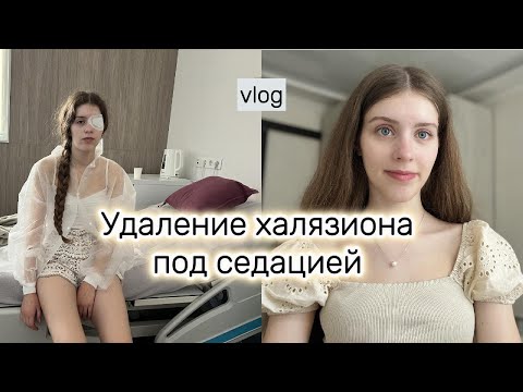 Видео: Удаление халязиона под седацией | Восстановления и советы после