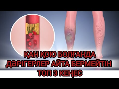 Видео: Қан Қою болғанда сұйылтатын 3 әдіс. Қанды қалай сұйылтуға болады