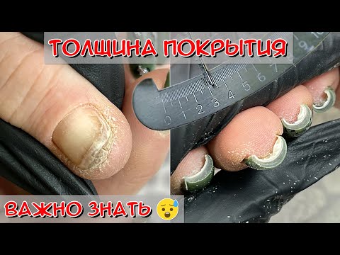 Видео: Ожог ногтей / Химический ожог ногтей