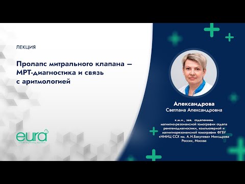 Видео: Пролапс митрального клапана – МРТ - диагностика и связь с аритмологией