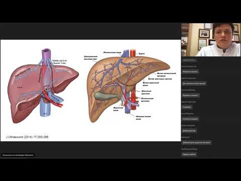 Видео: Пороки развития сосудов печени - Разумовский А.Ю.