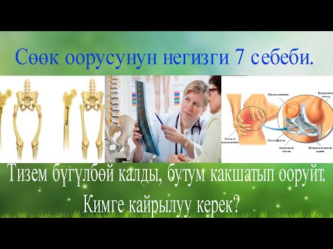 Видео: Сөөк оорусунун негизги 7 себеби. Тизем бүгүлбөй калды, бутум какшатып ооруйт. Кимге кайрылуу керек?