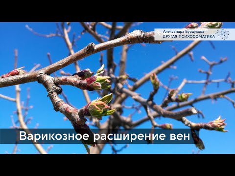 Видео: Варикоз. Психосоматика. Другая психосоматика