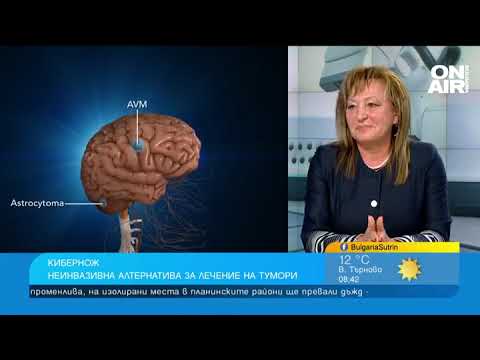 Видео: Пациенти с тумори се лекуват с нова технология за първи път в България