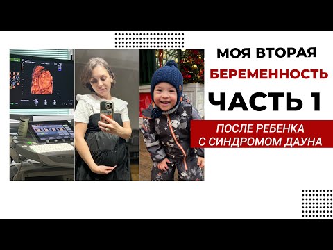 Видео: 🤰🏼 ЭКО И БЕРЕМЕННОСТЬ ПОСЛЕ РЕБЕНКА С СИНДРОМОМ ДАУНА. ЧАСТЬ 1.