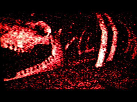 Видео: Железное легкое — это просто ужас