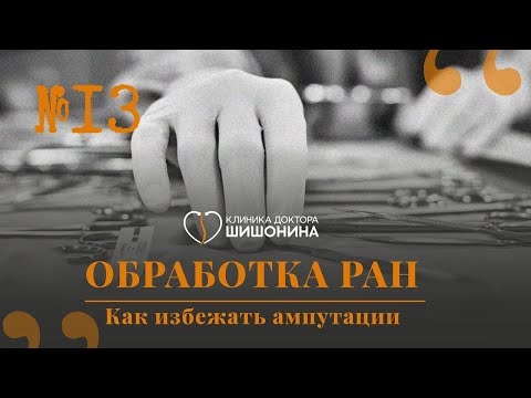 Видео: 🩸 Хирург про эффективные методы обработки ран. Как избежать ампутации? Подкаст "Хорошая медицина"
