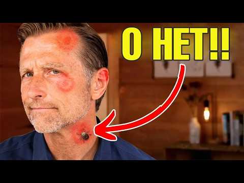 Видео: Как предотвратить боррелиоз (болезнь Лайма)?🧐