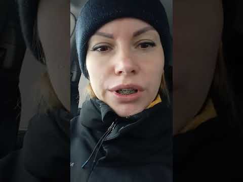 Видео: Брекеты через месяц. Цена установки