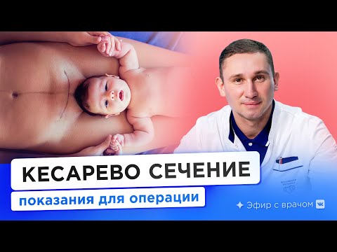 Видео: Кому делают кесарево сечение? Показания для КС