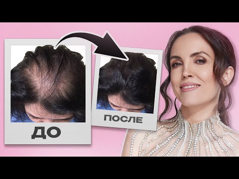 Видео: Это остановит выпадение волос НАВСЕГДА