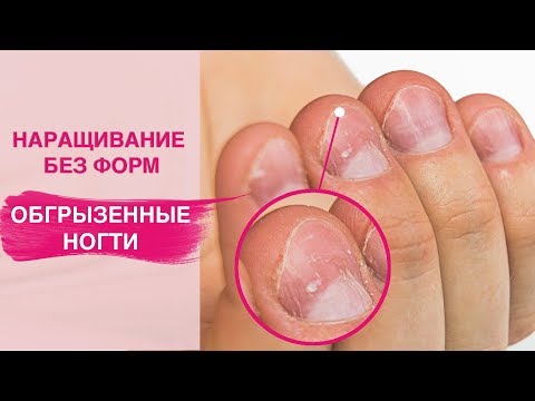Видео: Спасаем ОБКУСАННЫЕ ногти |  Наращивание полигелем на Ногти Грызуна