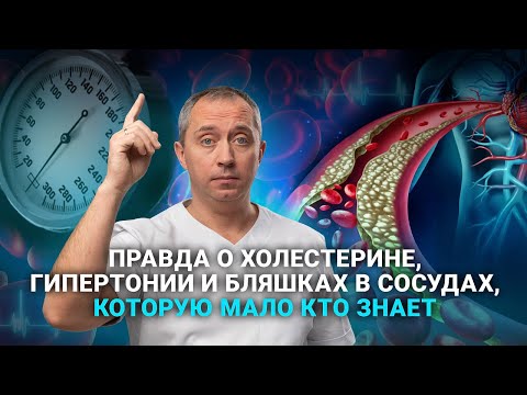 Видео: Вся правда о холестерине, гипертонии и бляшках в сосудах!