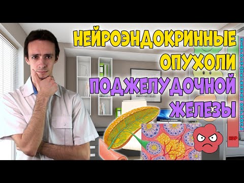 Видео: НЕЙРОЭНДОКРИННЫЕ опухоли ПОДЖЕЛУДОЧНОЙ ЖЕЛЕЗЫ: симптомы, диагностика, лечение.