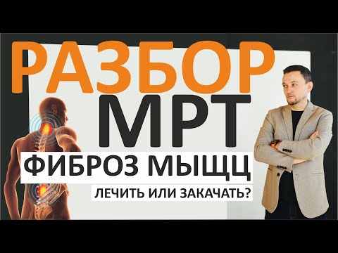 Видео: Болят мыщцы - мышечный корсет нужен или нет?