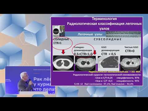 Видео: Попов - Эволюция выбора объемов и методов в хирургическом лечеии рака легкого