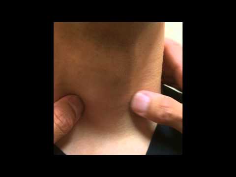 Видео: Упрощенное обследование щитовидной железы