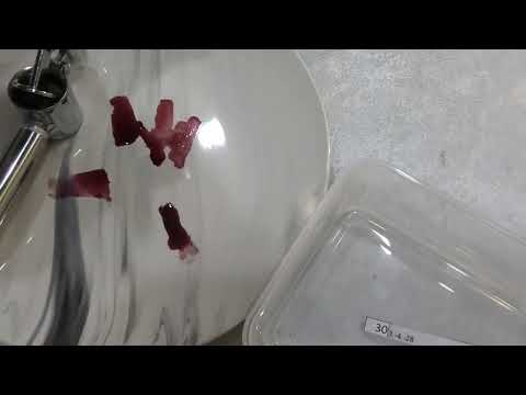 Видео: 5 серия ЖИМОЛОСТЬ замер сахара в ягоде