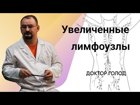 Видео: Увеличенные лимфоузлы - причины их увеличения.