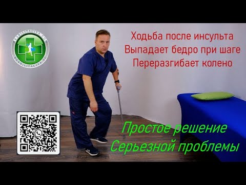 Видео: Нарушение походки после инсульта. Выпадает назад бедро парализованной ноги, переразгибает колено.