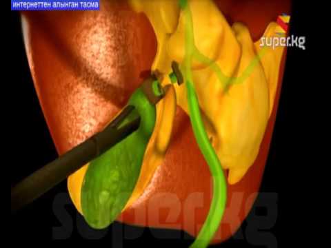 Видео: Өттүн алынып калышына жеткирбөө үчүн эмне кылуу керек?