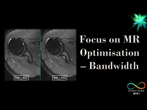 Видео: Фокус на оптимизации MR — пропускная способность