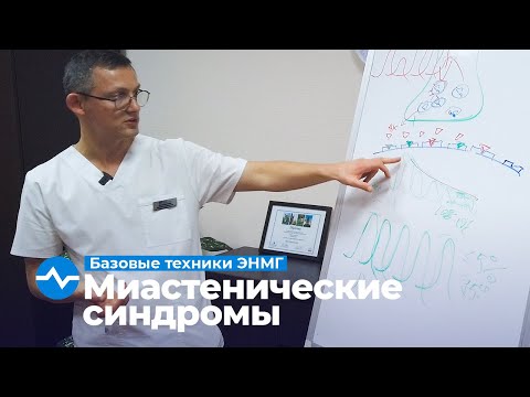 Видео: Миастенические синдромы. Прозериновая проба. Техники ЭНМГ. Курс Юрия Пономаренко.