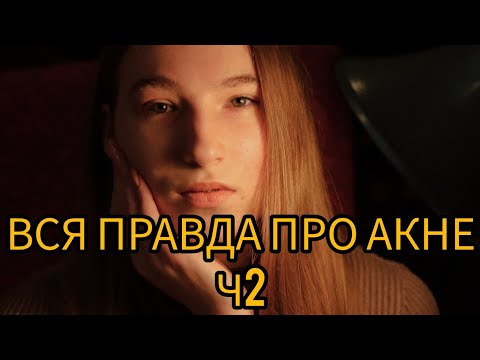 Видео: Акне .Моя власна історія.Ч2