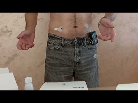 Видео: Замена трансмиттера MiniLink Medtronic 780g