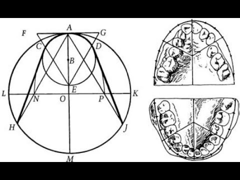 Видео: Ортодонтия. Диаграмма Хаулея Гербера Гербста. Графический метод обследования.