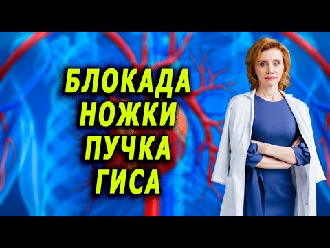 Видео: Блокада ножки пучка гиса. Кардиолог. Анна Кореневич