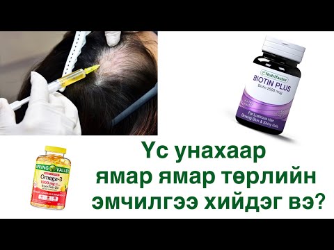 Видео: үс уналтын эмчилгээ