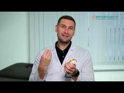 Видео: Спондилоартроз или фасет синдром