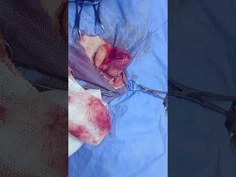 Видео: Цистотомия у кошки при небольшом камне: извлечение небольшого камня из мочевого пузыря кошки.