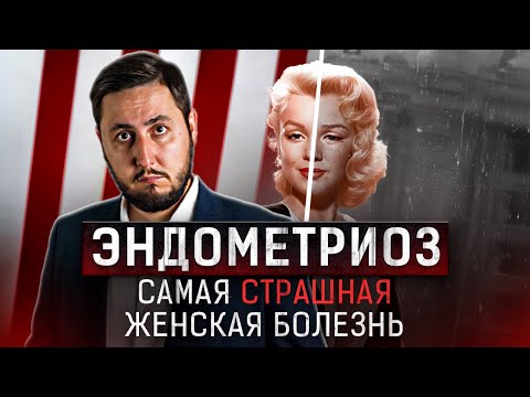 Видео: ЭНДОМЕТРИОЗ — самая СТРАШНАЯ женская болезнь