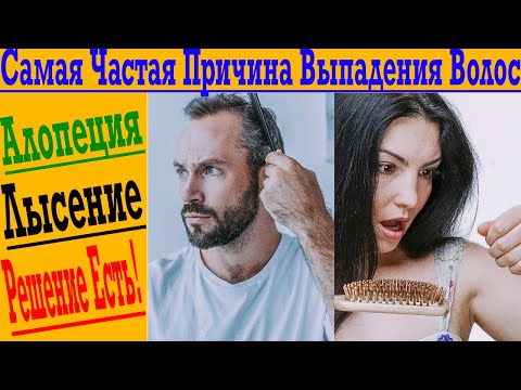 Видео: Главная Причина Выпадения Волос!
