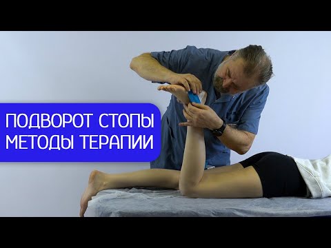 Видео: Последствия подворота стопы. Диагностика и терапия