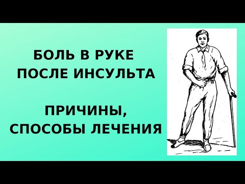 Видео: Боль в руке после инсульта