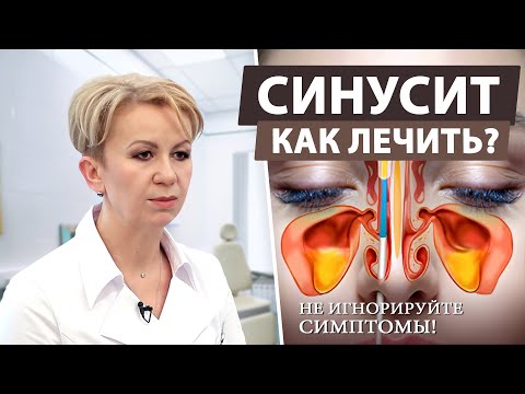 Видео: Как вылечить синусит без осложнений: симптомы и лечение воспаления пазух