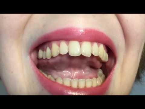 Видео: Дифференциация звуков Р-Рь (видеоурок)