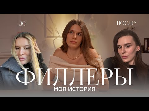 Видео: Филлеры: мой опыт, последствия