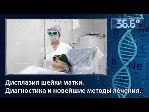 Видео: Дисплазия шейки матки: диагностика и новейшие способы лечения.